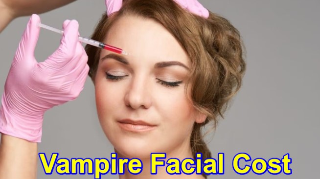 Vampire Facial Cost