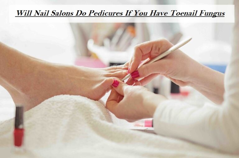 Will Nail Salons Do Pedicures If You Have Toenail Fungus